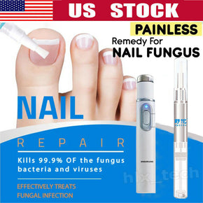 Anti-fungal Home Treatment Set Laser Pen Finger Toe Nail Fungus Care Liquid Kit.