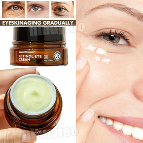 Retinol Eye Cream Instant Remove Eye Bag Dark Circles Anti Aging Eye Firm Serum